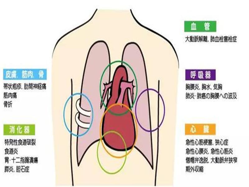 2018年《急性胸痛》-文档资料.pptx_第3页