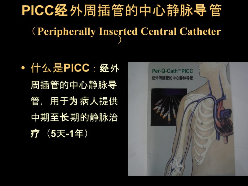 2018年picc置管术及护理郭梅(5)-文档资料.ppt_第1页