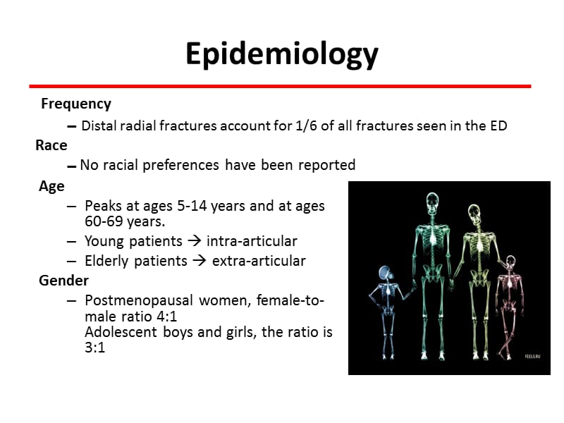 最新distal radius fracture 桡骨远端骨折-PPT文档.pptx_第2页