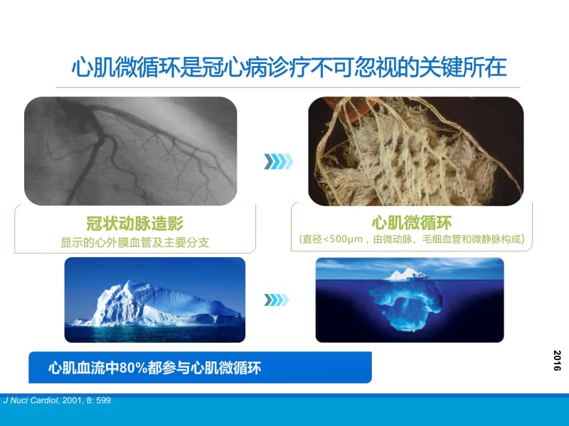 冠脉微血管病变-精选文档.pptx_第3页