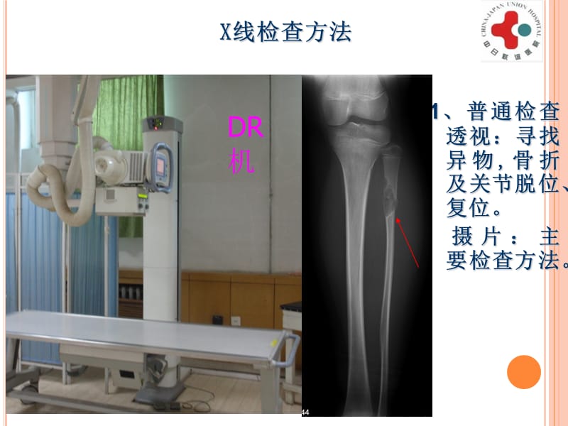 影像学-1骨骼-文档资料.ppt_第3页