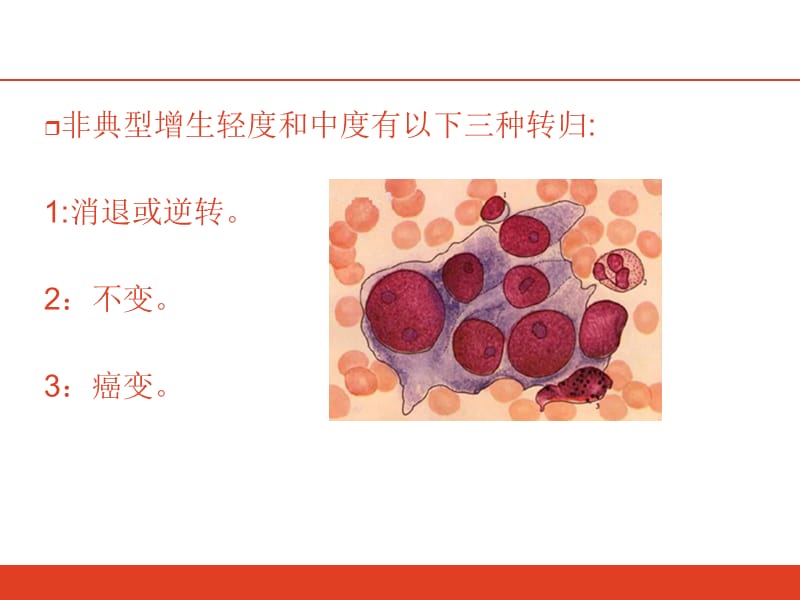 宫颈腺体鳞化什么意思-文档资料.ppt_第2页