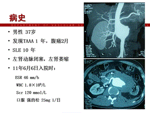 2018年杂交手术治疗活动期炎Ⅳ型胸腹主动脉瘤教学课件-文档资料.ppt