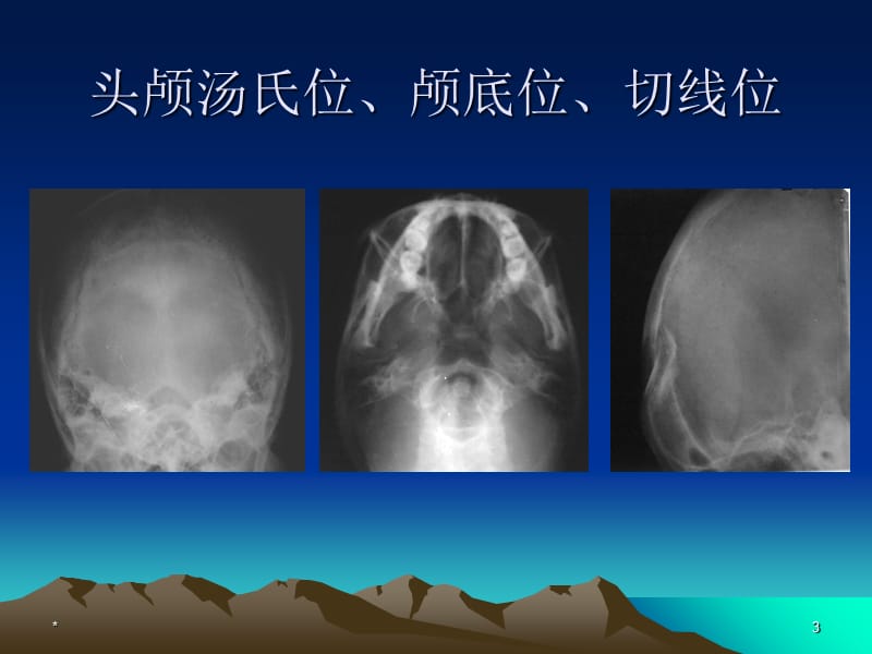 中枢神经系统疾病ppt课件-文档资料.ppt_第3页