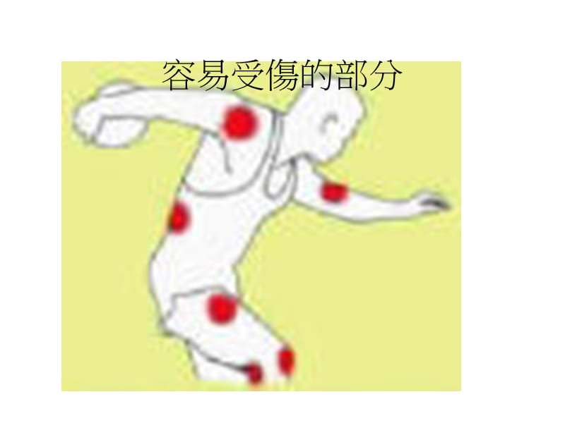 事故伤害和急救-PPT文档.ppt_第2页