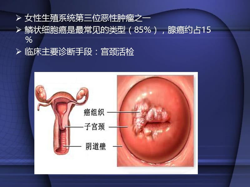 宫颈癌靶区勾画-PPT文档.pptx_第1页