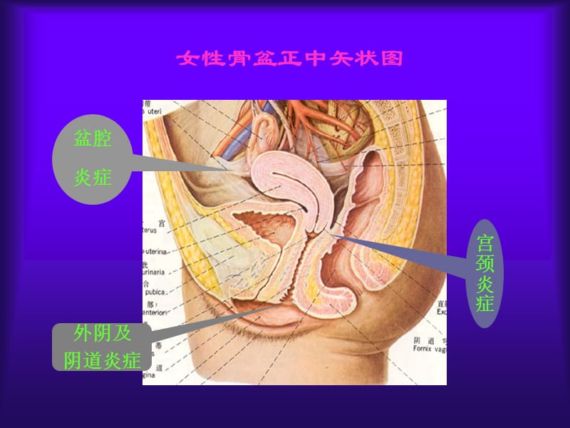 女性生殖系统炎症94-文档资料.ppt_第1页