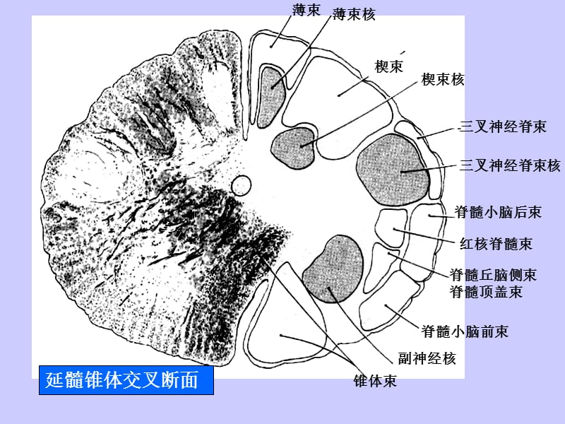 局部解剖学 脑干断面图-精选文档.ppt_第2页