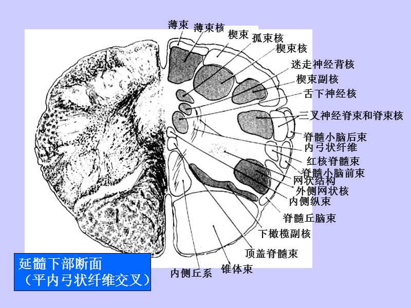 局部解剖学 脑干断面图-精选文档.ppt_第3页