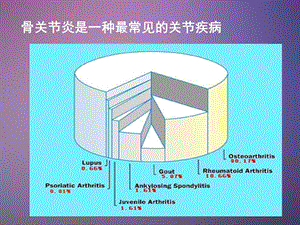 《骨关节炎》ppt课件-精选文档.ppt