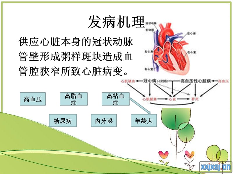 【医药健康】激光心肌血管重建术-文档资料.ppt_第2页