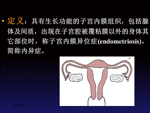 【医药健康】中医妇科学--子宫内膜异位症-PPT文档.ppt