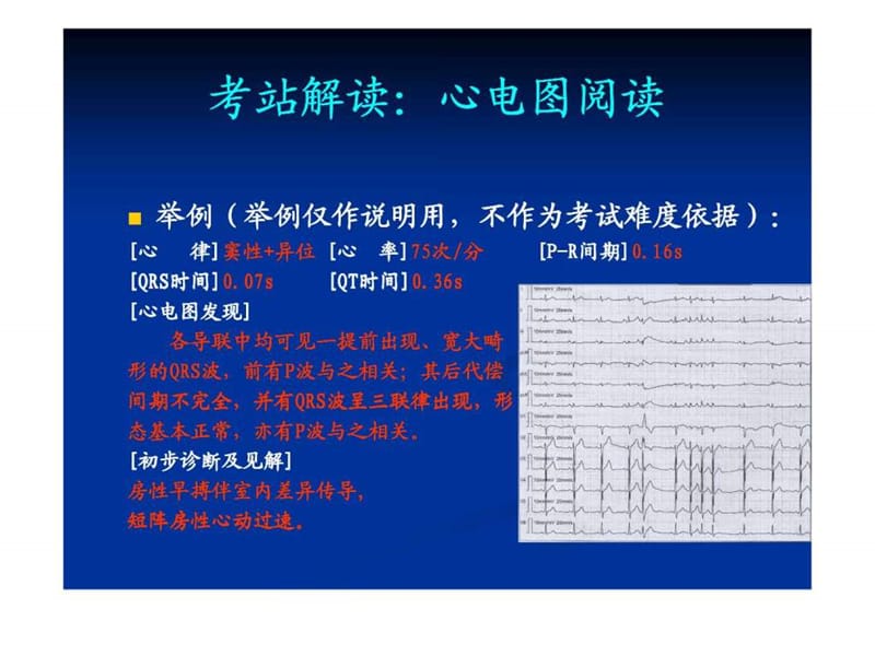 《心电图培训实训》PPT课件-精选文档.ppt_第2页