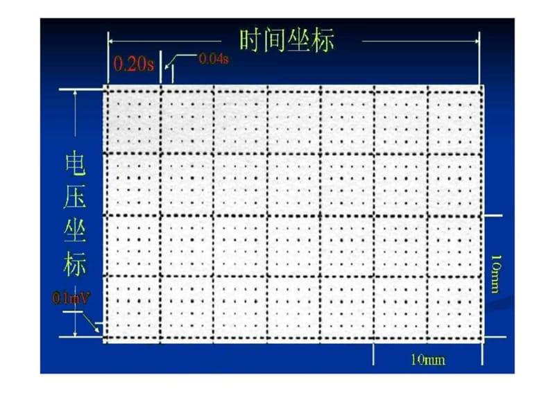 《心电图培训实训》PPT课件-精选文档.ppt_第3页