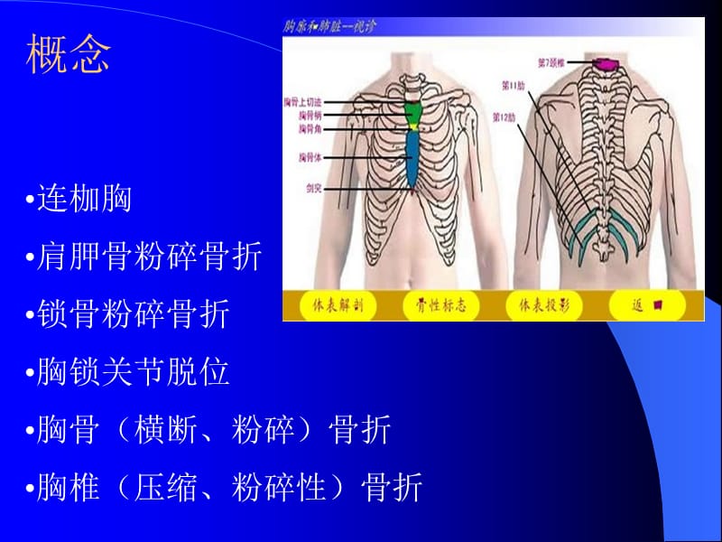 严重胸廓创伤的修复-精选文档.ppt_第3页