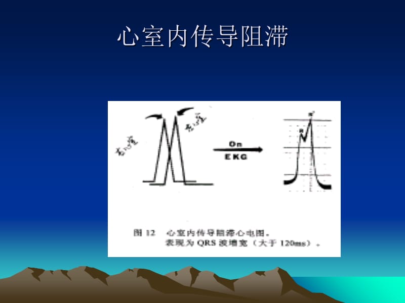 2018年心力衰竭患者心脏再同步治疗及猝死的预防CRT_ICD适应证-课件，幻灯，PPT-文档资料.ppt_第3页