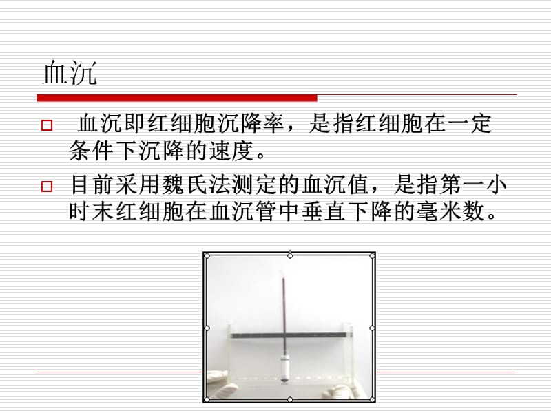 2018年临床部分实验室检测的的结果意义-文档资料.ppt_第1页