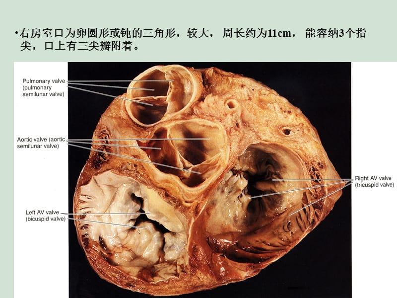 2018年心的瓣膜复合器研究进展和临床应用-文档资料.ppt_第3页