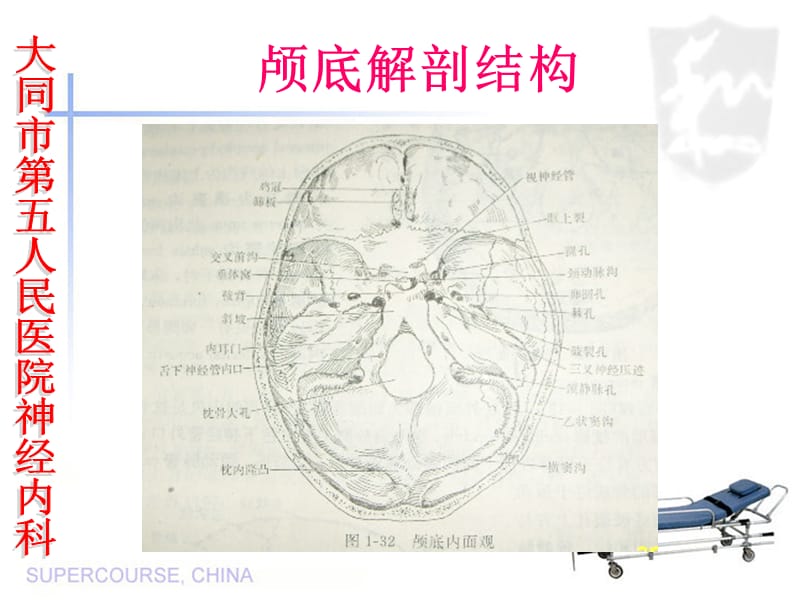 多颅神经损害综合-文档资料.ppt_第1页