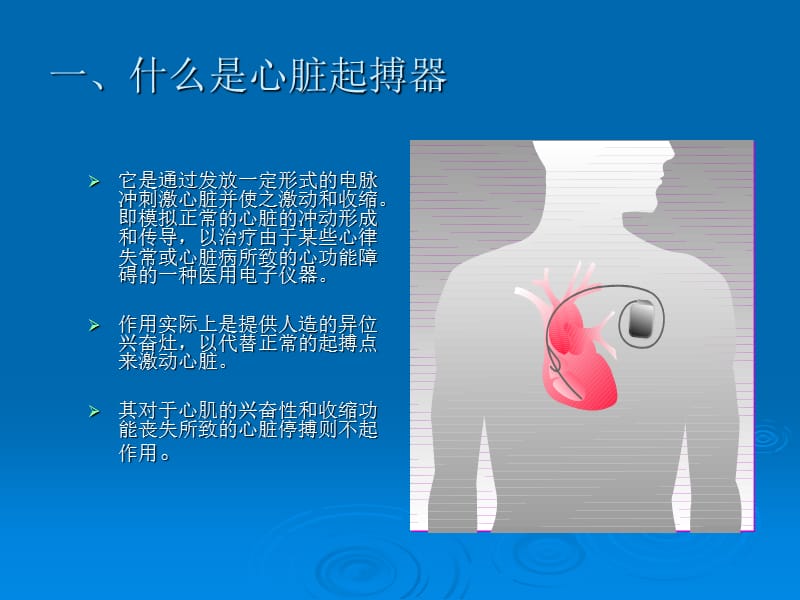 人工心脏起搏器-精选文档.ppt_第2页