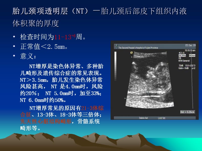 产科超声检查指标-精选文档.ppt_第3页