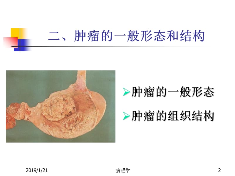 11肿瘤总论大纲-PPT课件.ppt_第2页