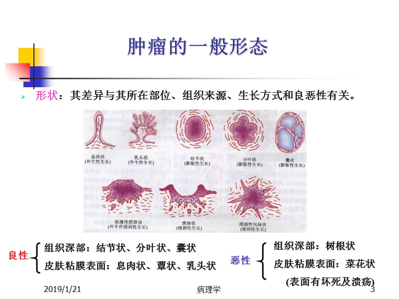 11肿瘤总论大纲-PPT课件.ppt_第3页