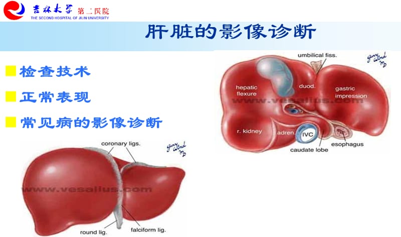 影像学-08肝胆疾病-精选文档.ppt_第1页