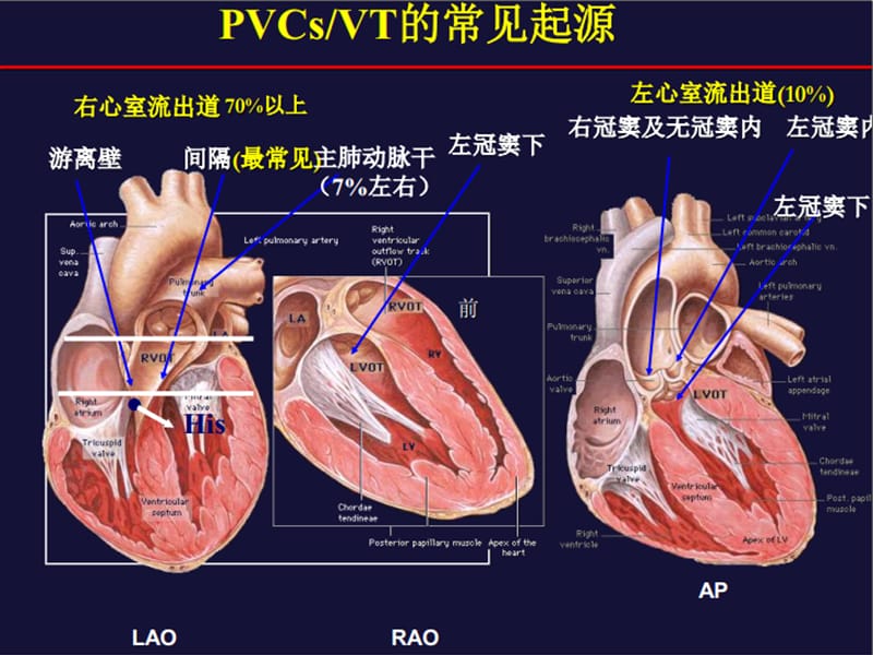 室早室速体表心电图定位诊断.ppt_第2页