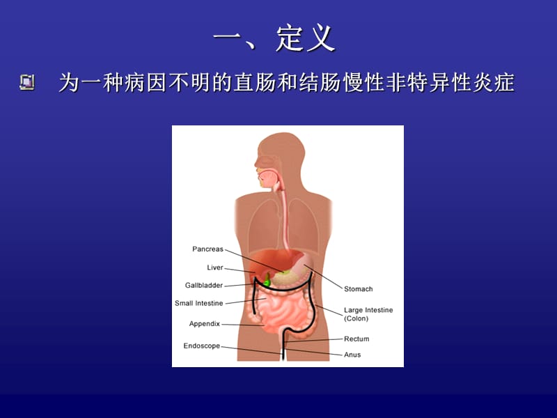 2018年内科护理学《第四章消化系统疾病患者的护理》PPT-第六节 溃疡性结肠炎患者的护理-文档资料.ppt_第2页