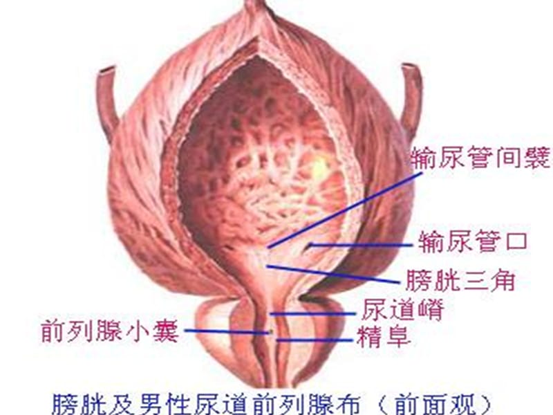 2018年膀胱肿瘤-文档资料.ppt_第3页