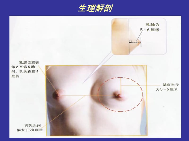 乳房疾病概述-精选文档.ppt_第1页