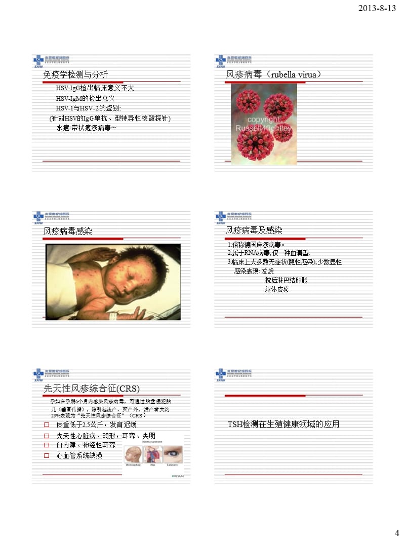 TORCH和TSH检测的临床应用(1)-文档资料.ppt_第3页