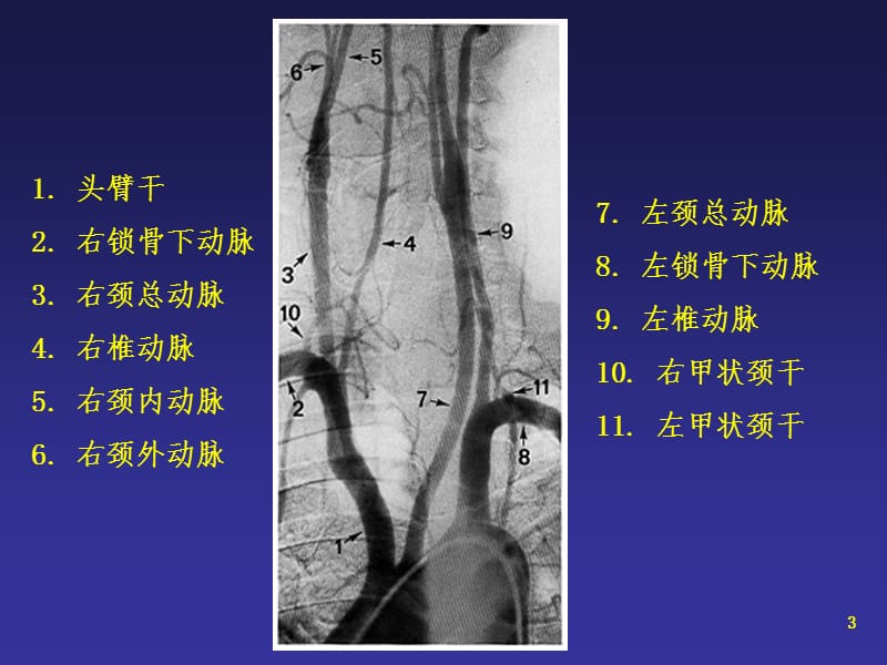 2018年头颈部动脉解剖-文档资料.ppt_第3页