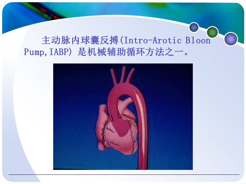 主动脉球囊反搏iabp的应用和护理ppt课件-PPT文档.ppt_第1页