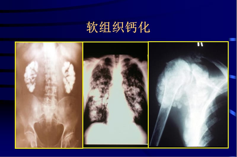 2018年慢性肾脏病时的钙磷代谢异常及骨病-文档资料.ppt_第2页