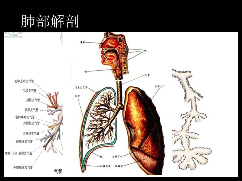 慢性支气管炎肺炎等修改-PPT文档.ppt_第2页