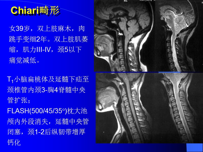 2018年10-MRI图像-脑1-文档资料.ppt_第1页