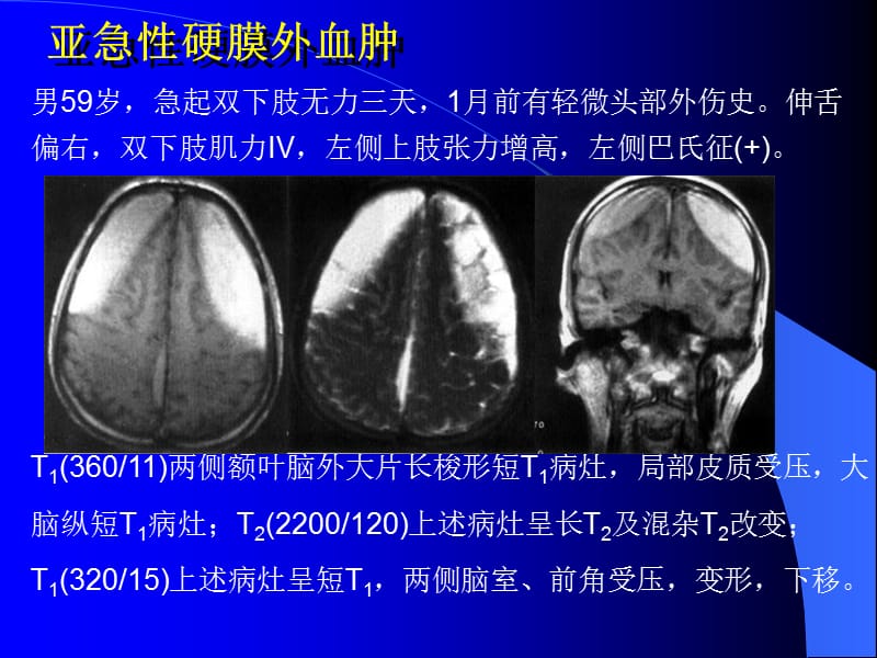 2018年10-MRI图像-脑1-文档资料.ppt_第3页