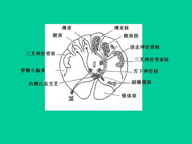 局部解剖学 - 脑干断面图(作业)01-精选文档.ppt_第2页