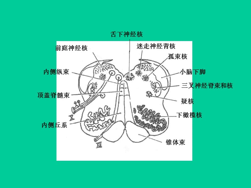 局部解剖学 - 脑干断面图(作业)01-精选文档.ppt_第3页