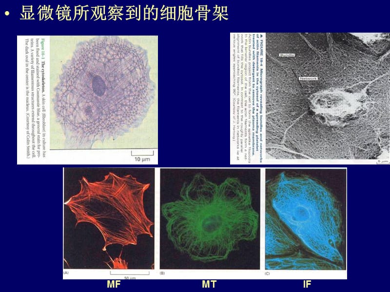 13-14细胞骨架-PPT课件.ppt_第3页