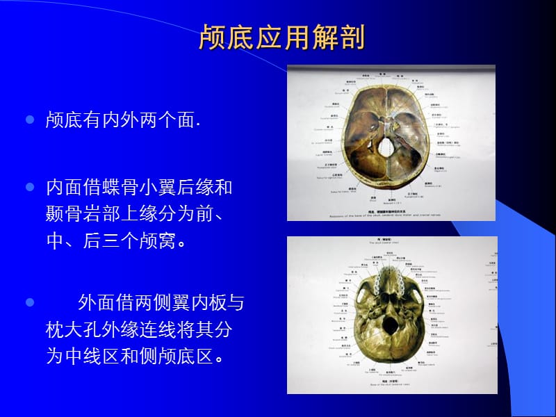 2018年颅底应用解剖-文档资料.ppt_第2页