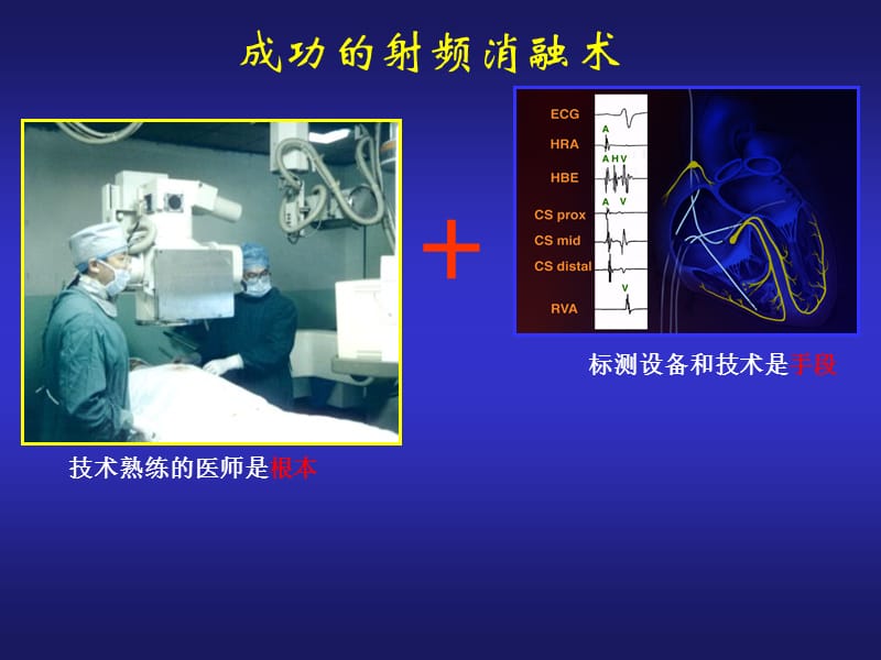 心脏电生理介入治ppt课件-PPT文档.ppt_第2页