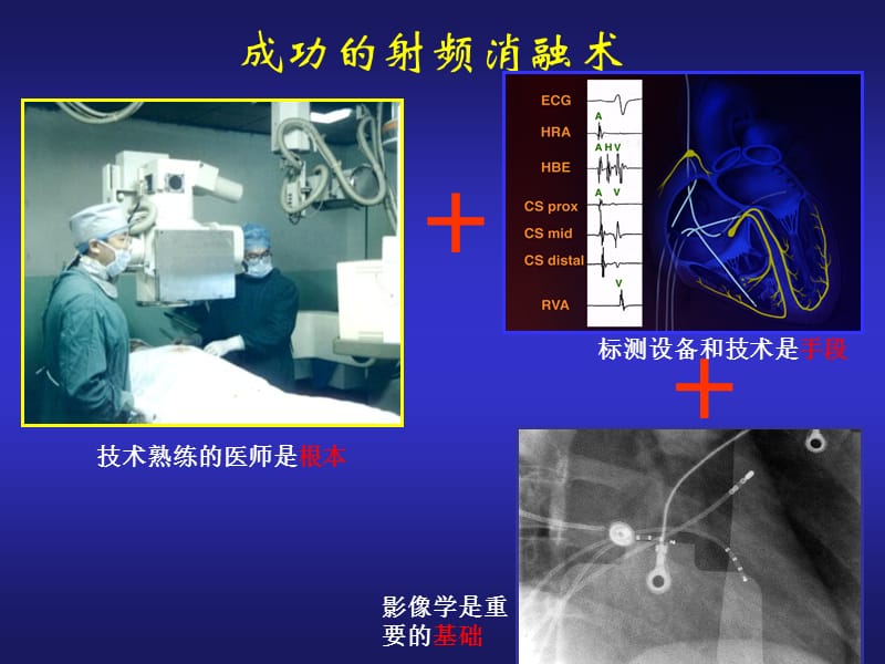 心脏电生理介入治ppt课件-PPT文档.ppt_第3页