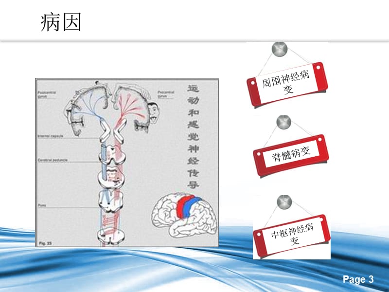 2018年下肢麻木症状相关疾病鉴别-文档资料.pptx_第3页