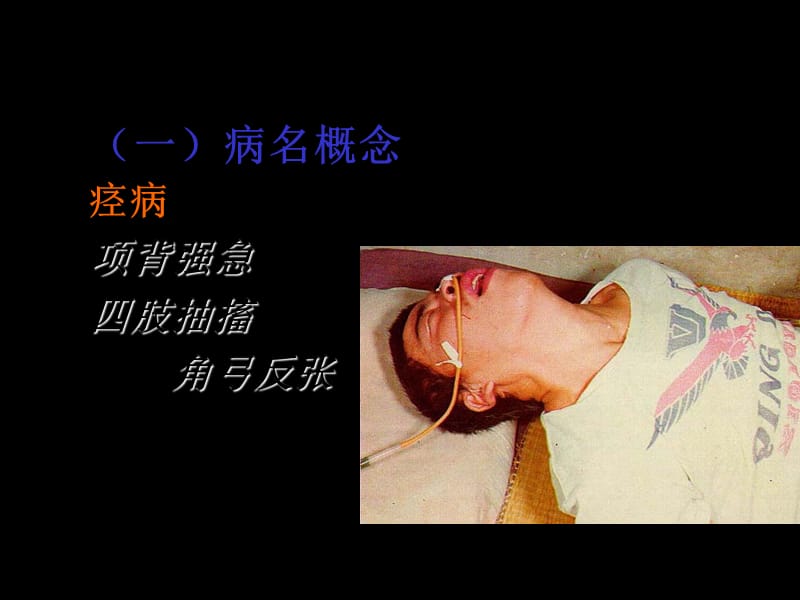 北京大学中医内科学课件07痉病-精选文档.ppt_第2页