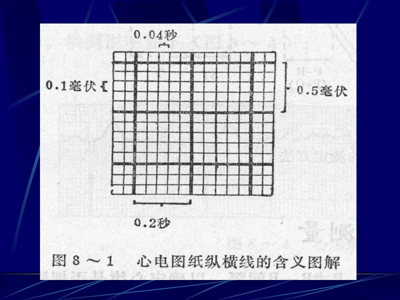 最新心电-一院心电-心肌缺血+心梗+心律失常-PPT文档.ppt_第2页