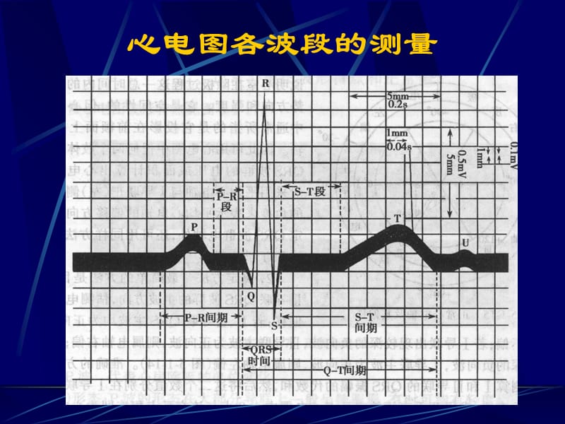 最新心电-一院心电-心肌缺血+心梗+心律失常-PPT文档.ppt_第3页