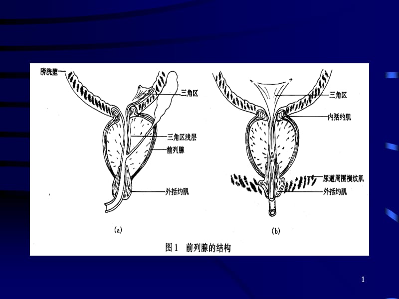 前列腺增生症的临床表现,诊断和治疗-文档资料.ppt_第1页